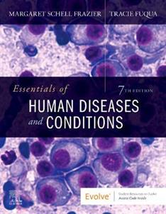 Essentials Human Diseases amp; Condition 7E - Click Image to Close