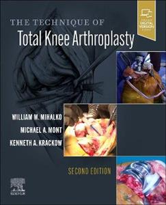 The Technique of Total Knee Arthroplasty - Click Image to Close