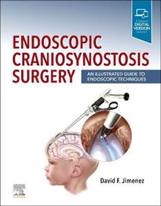 Endoscopic Craniosynostosis Surgery - Click Image to Close