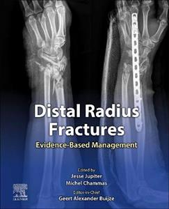 Distal Radius Fractures - Click Image to Close