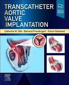 Transcatheter Aortic Valve Implantation - Click Image to Close