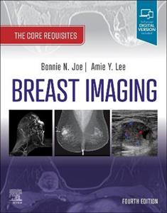Breast Imaging 4E - Click Image to Close