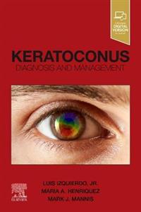 Keratoconus: Diagnosis and Management - Click Image to Close