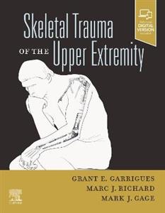 Skeletal Trauma of the Upper Extremity - Click Image to Close