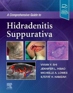 A Comprehensive Guide to Hidradenitis