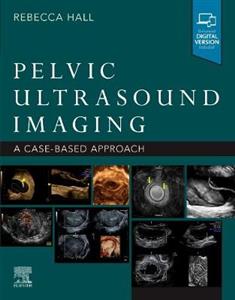 Pelvic Ultrasound Imaging - Click Image to Close