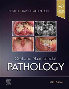 Oral and Maxillofacial Pathology - Click Image to Close