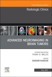 Advanced Neuroimaging in Brain Tumors
