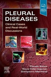 Pleural Diseases - Click Image to Close