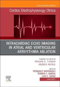 Intracardiac Echo Imag Atrial Venticular - Click Image to Close