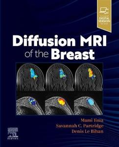 Diffusion MRI of the Breast - Click Image to Close