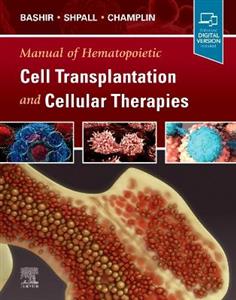 Manual Stem Cell Transplant Cell Thera - Click Image to Close
