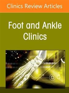 Alternatives to Ankle Joint Replacement,