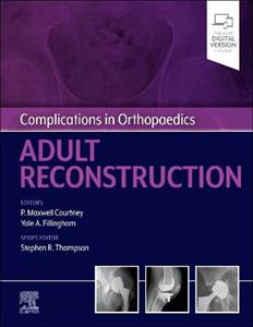 Complications in Orthopaedics - Click Image to Close