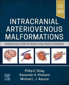 Intracranial Arteriovenous Malformations: Essentials for Patients and Practitioners - Click Image to Close