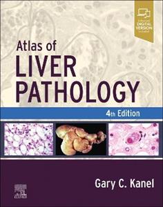 Atlas of Liver Pathology - Click Image to Close