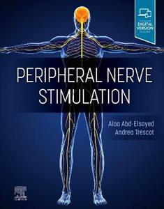 Peripheral Nerve Stimulation - Click Image to Close