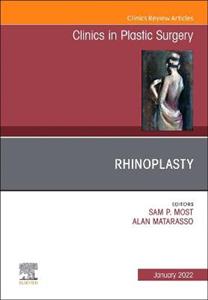 Rhinoplasty,Issue Clin in Plastic Surg - Click Image to Close