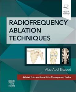 Radiofrequency Ablation Techniques - Click Image to Close