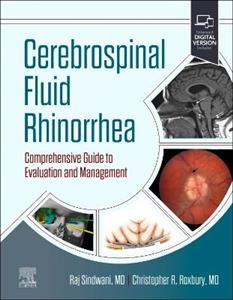 Cerebrospinal Fluid Rhinorrhea - Click Image to Close