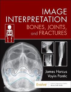 Image Interpretation: Bones, Joints, and Fractures - Click Image to Close