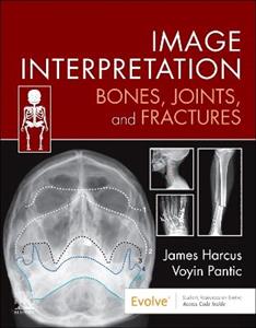 Image Interpretation: Bones, Joints, and Fractures