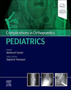 Complications in Orthopaedics: Pediatrics - Click Image to Close