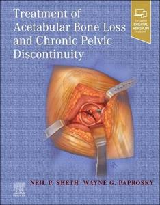 Acetabular Bone Loss Pelvic Discontinuit