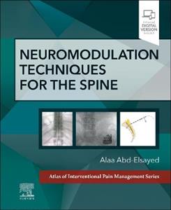 Neuromodulation Techniques for the Spine - Click Image to Close