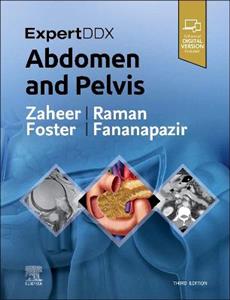 ExpertDDx: Abdomen and Pelvis , 3rd Edition