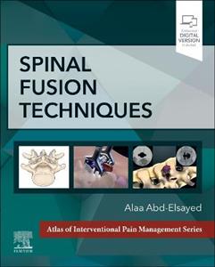 Spinal Fusion Techniques - Click Image to Close