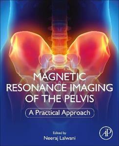 Magnetic Resonance Imaging of The Pelvis: A Practical Approach - Click Image to Close