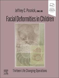 Facial Deformities in Children 1e