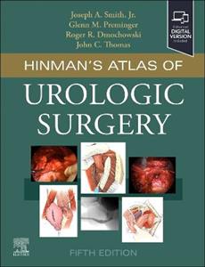 Hinman's Atlas of Urologic Surgery
