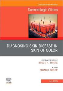 Diagnosing Skin Disease in Skin of Color - Click Image to Close