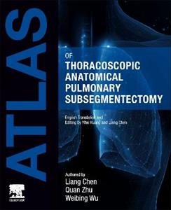 Atlas of Thoracoscopic Anatomical Pulmonary Subsegmentectomy - Click Image to Close