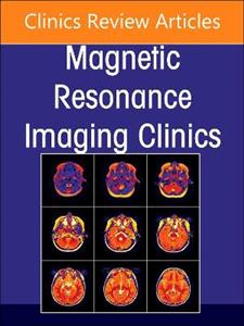 MR Imaging of the Adnexa, An Issue of Ma