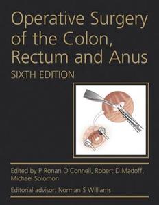 Operative Surgery of the Colon, Rectum and Anus