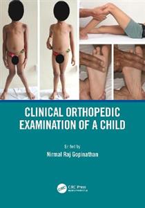 Clinical Orthopedic Examination of a Child - Click Image to Close