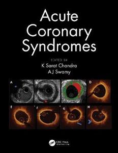 Acute Coronary Syndromes - Click Image to Close