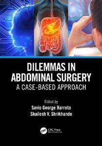 Dilemmas in Abdominal Surgery