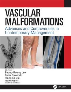 Vascular Malformations - Click Image to Close