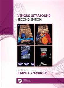 Venous Ultrasound - Click Image to Close