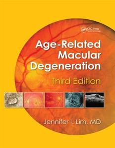 Age-Related Macular Degeneration, Third Edition - Click Image to Close