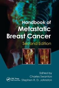 Handbook of Metastatic Breast Cancer - Click Image to Close