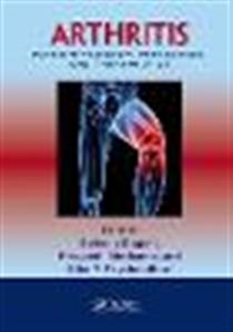 Arthritis: Pathophysiology, Prevention, and Therapeutics - Click Image to Close