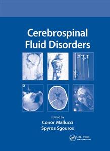 Cerebrospinal Fluid Disorders - Click Image to Close