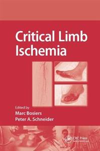 Critical Limb Ischemia - Click Image to Close