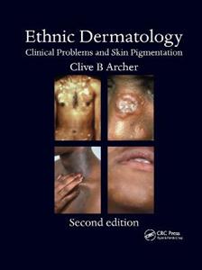 Ethnic Dermatology - Click Image to Close