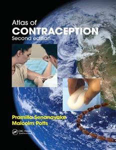 Atlas of Contraception - Click Image to Close